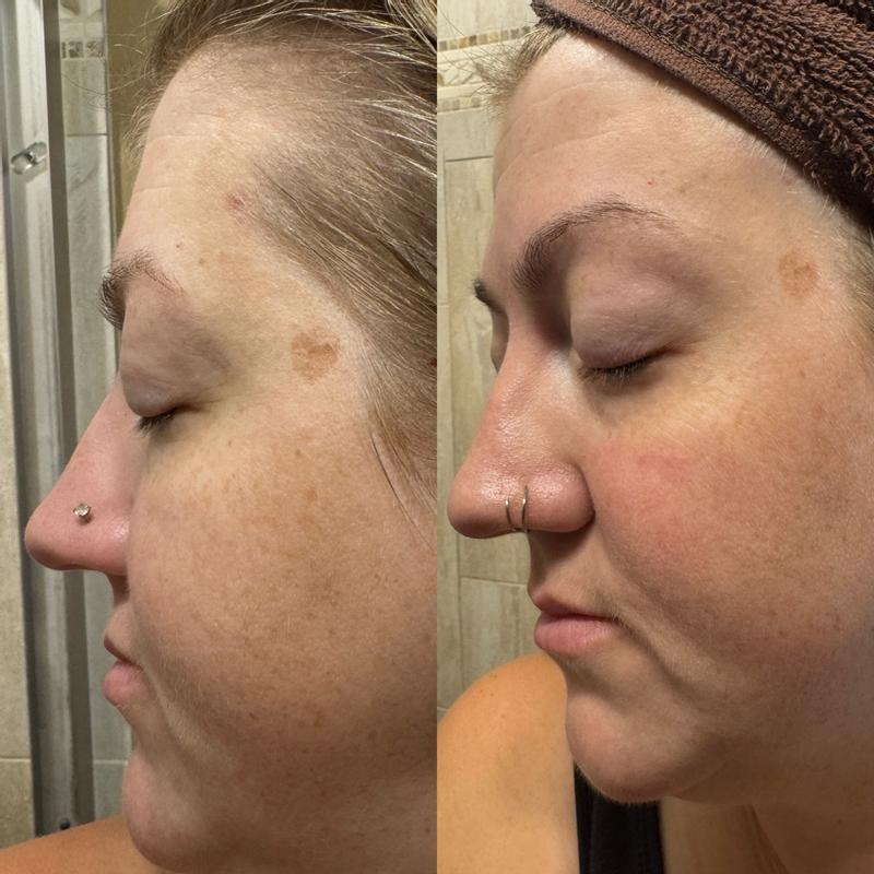Triple C Serum