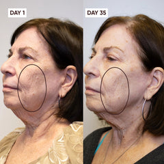 Before and after comparison of a woman's face with visible skin texture changes over 35 days.