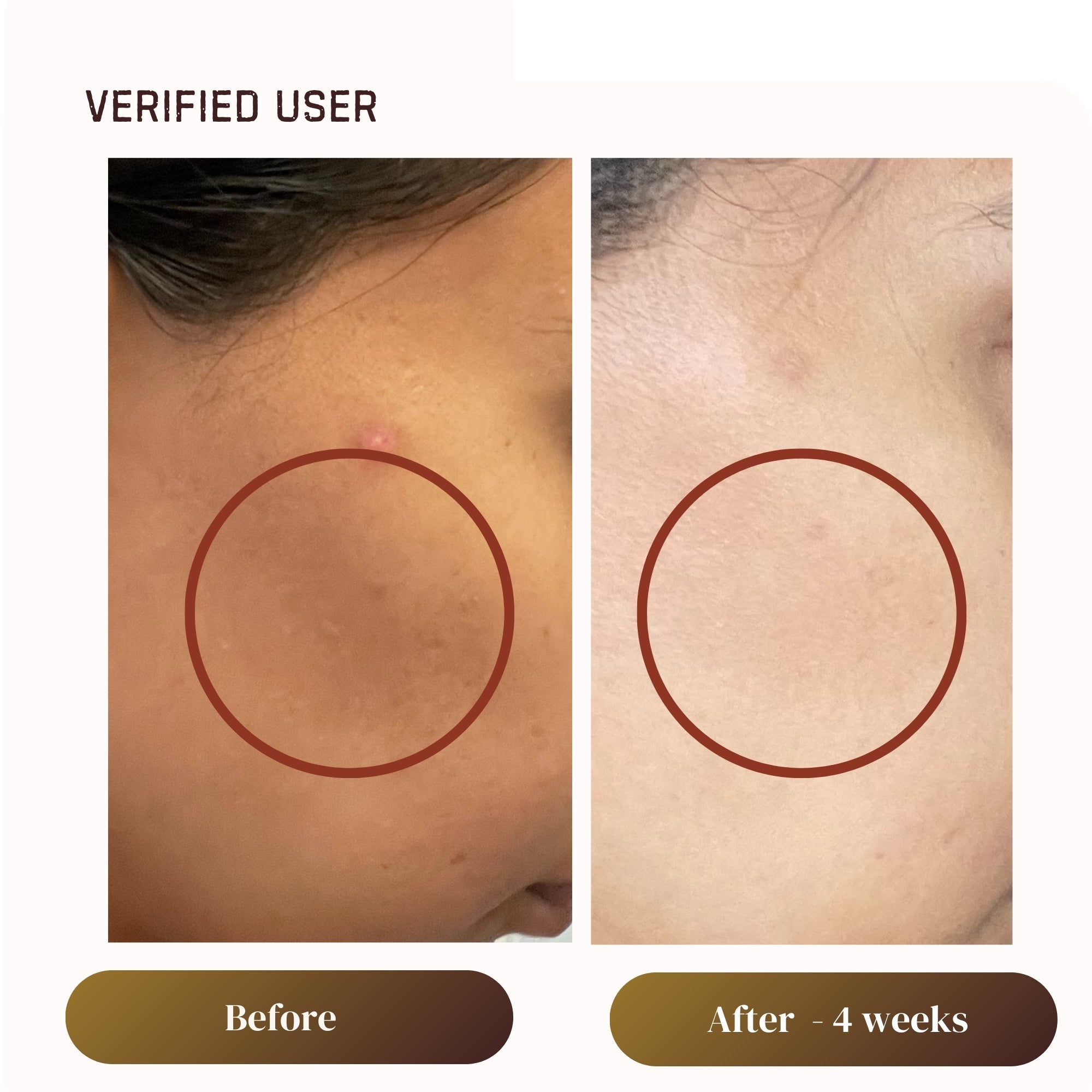 Gentle Exfoliating Gel Cleanser