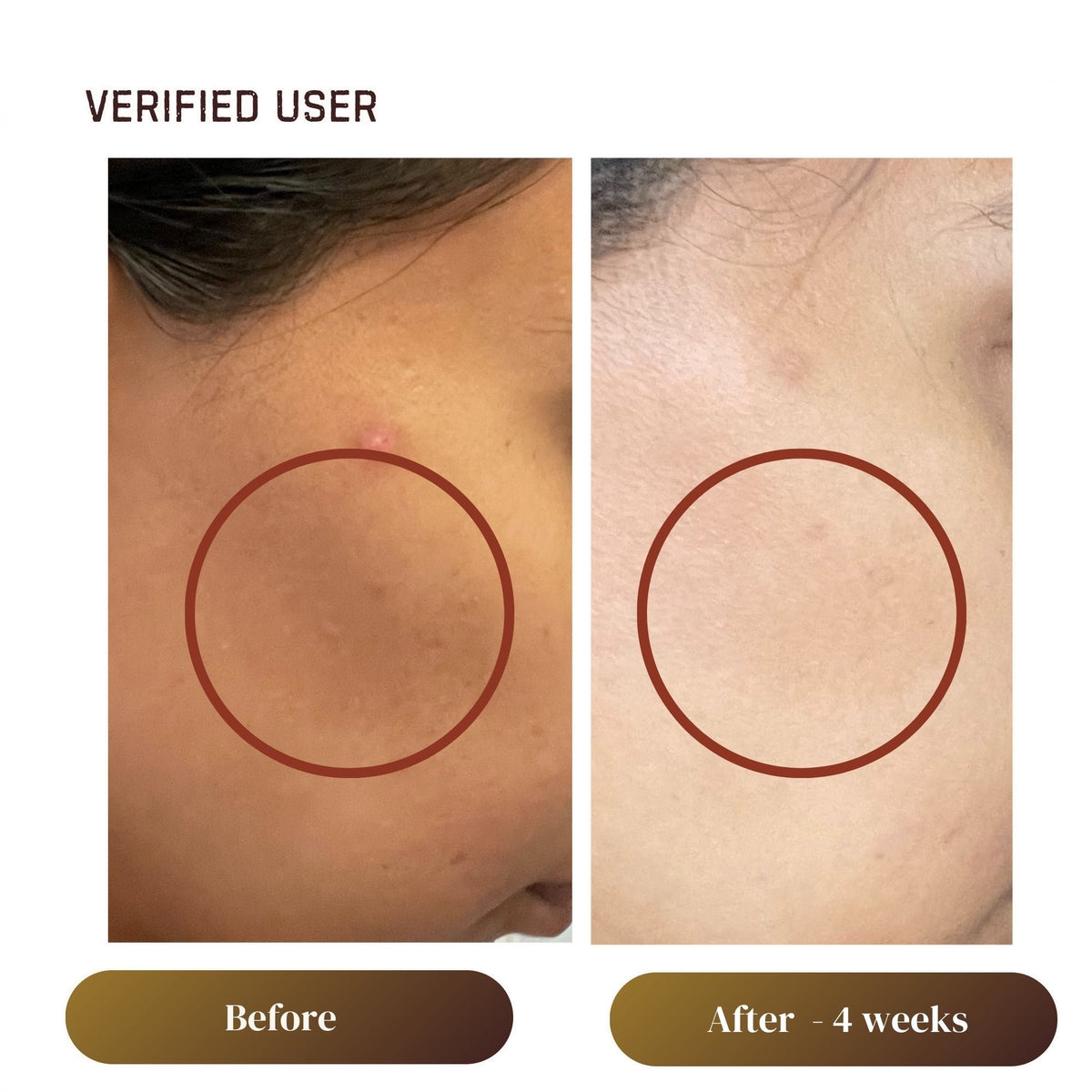 Gentle Exfoliating Gel Cleanser